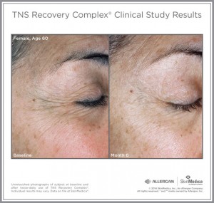 TNS Recovery Complex